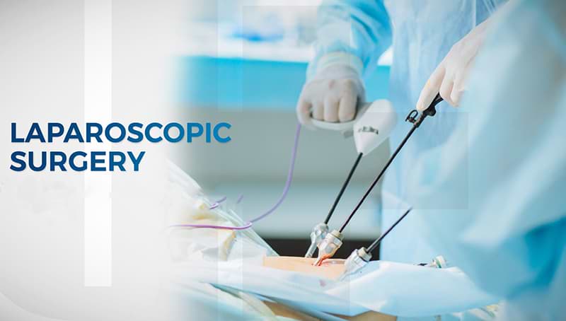 laparoscopic-surgery-in-India